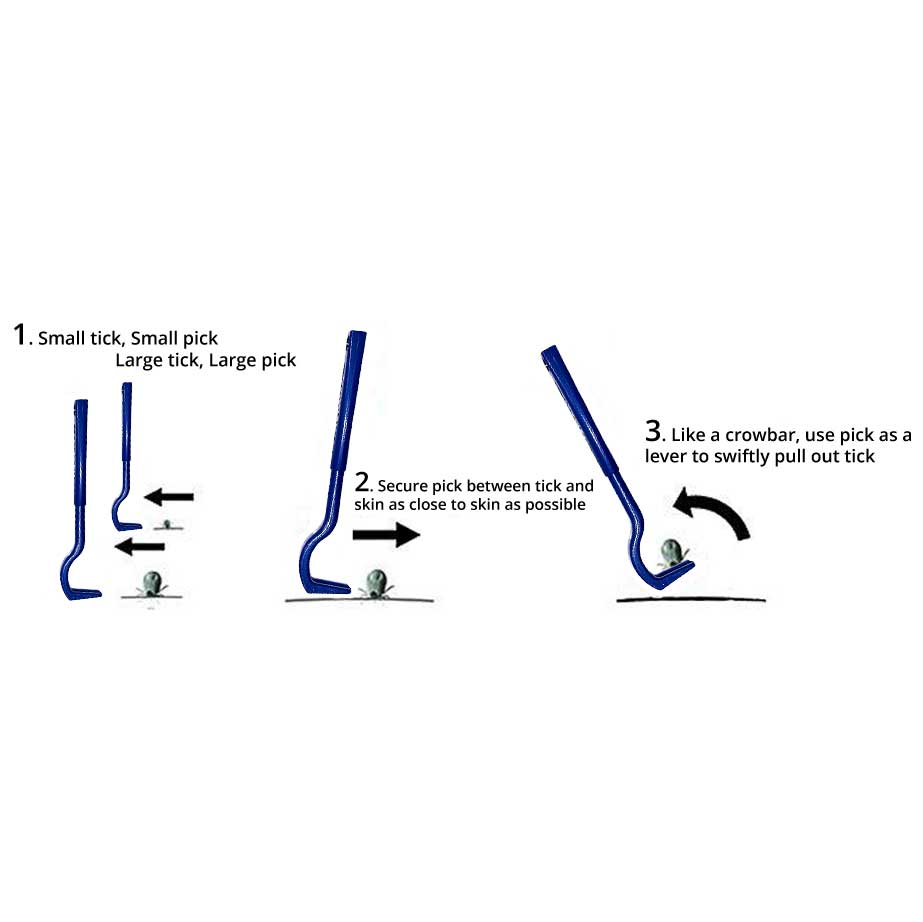 AtlanTick - TickPick® – The Ultimate Double-Sided Tick Removal Tool