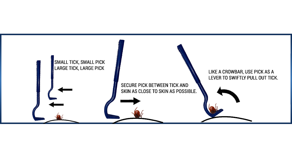 AtlanTick - Tick Kit – Your All-in-One Tick Removal & Protection Solution